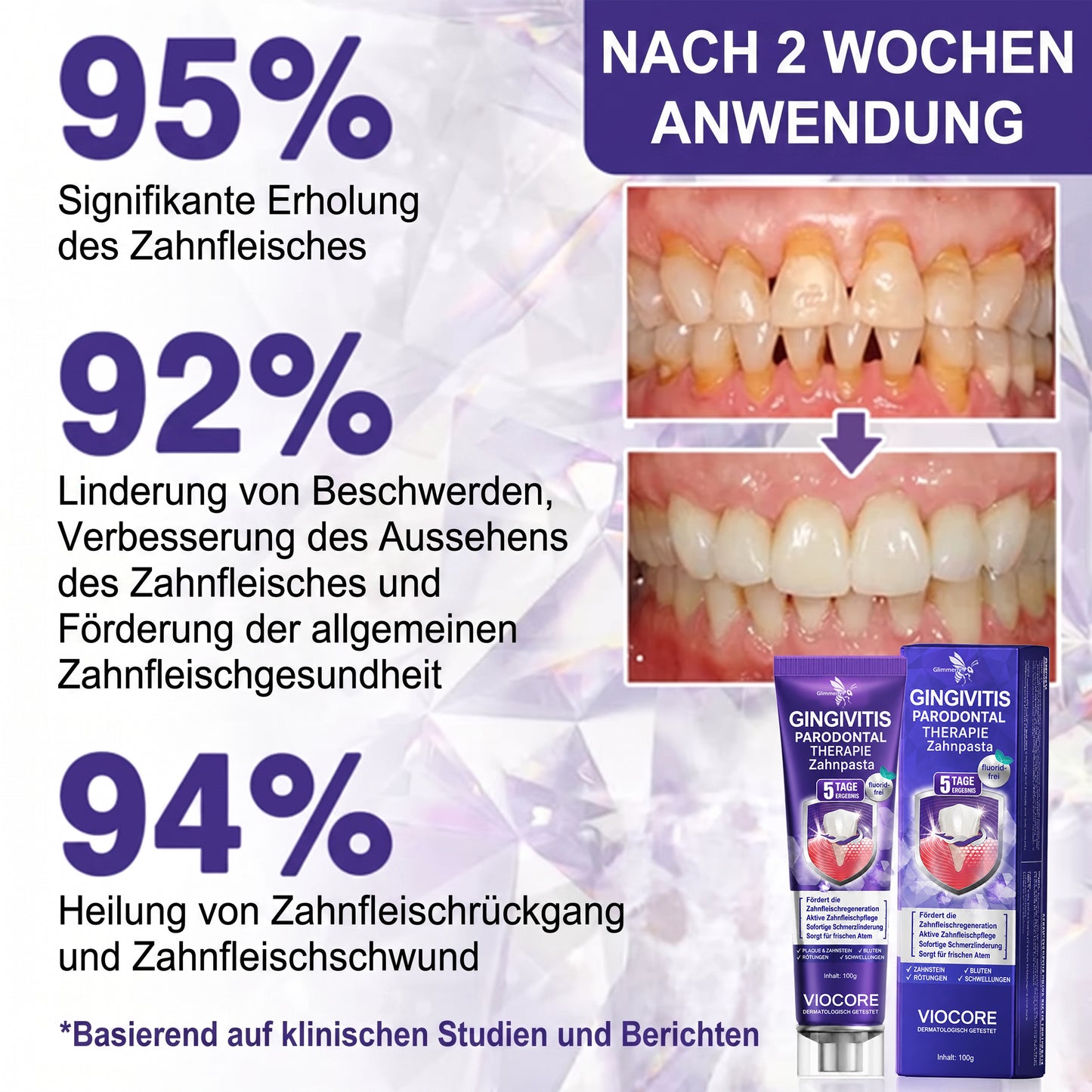 Glimmerly®🦷 VioCore Zahnpasta zur Behandlung von Zahnfleischentzündungen und Parodontitis mit Bienengift🌻