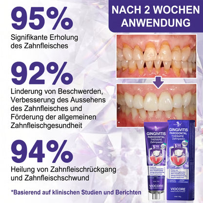 Glimmerly®🦷 VioCore Zahnpasta zur Behandlung von Zahnfleischentzündungen und Parodontitis mit Bienengift🌻
