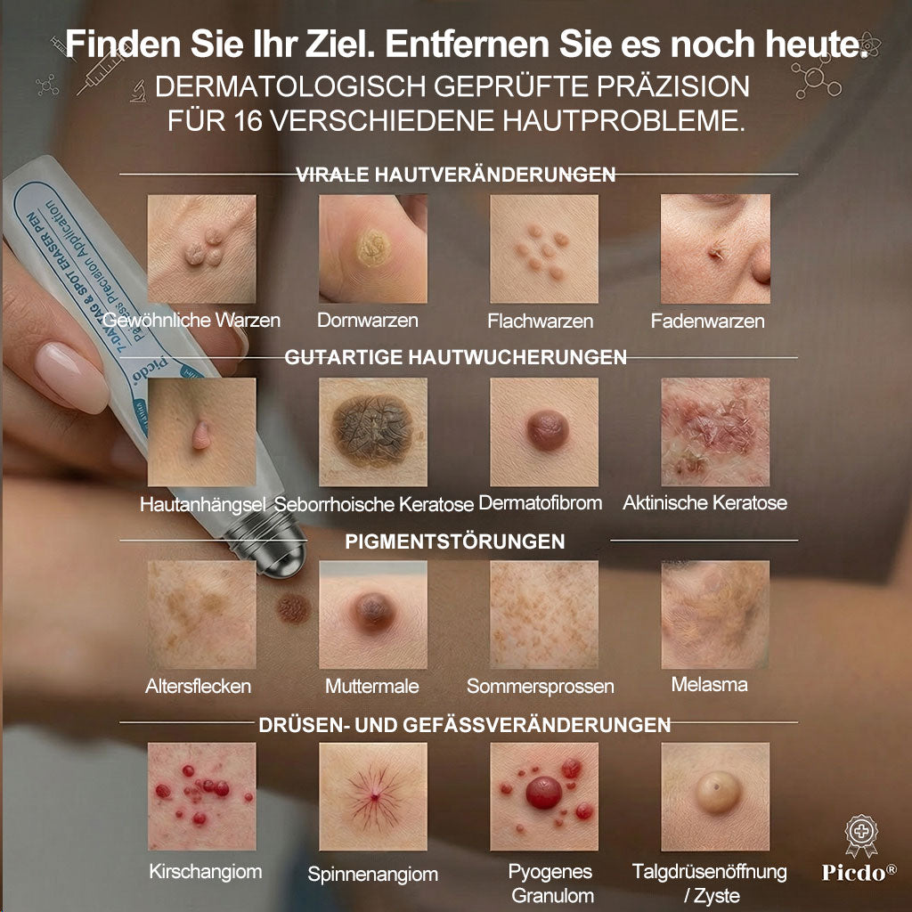 Offizieller Markenstore❄️𝑷𝑖𝒄𝐝𝐨® 7-𝑻𝒂𝒈𝒆 𝑯𝒂𝒖𝒕𝒂𝒏𝒉ä𝒏𝒈𝒔𝒆𝒍- & 𝑭𝒍𝒆𝒄𝒌𝒆𝒏𝒆𝒏𝒕𝒇𝒆𝒓𝒏𝒆𝒓(Schmerzfreier Rollerball – Keine Narbenbildung)